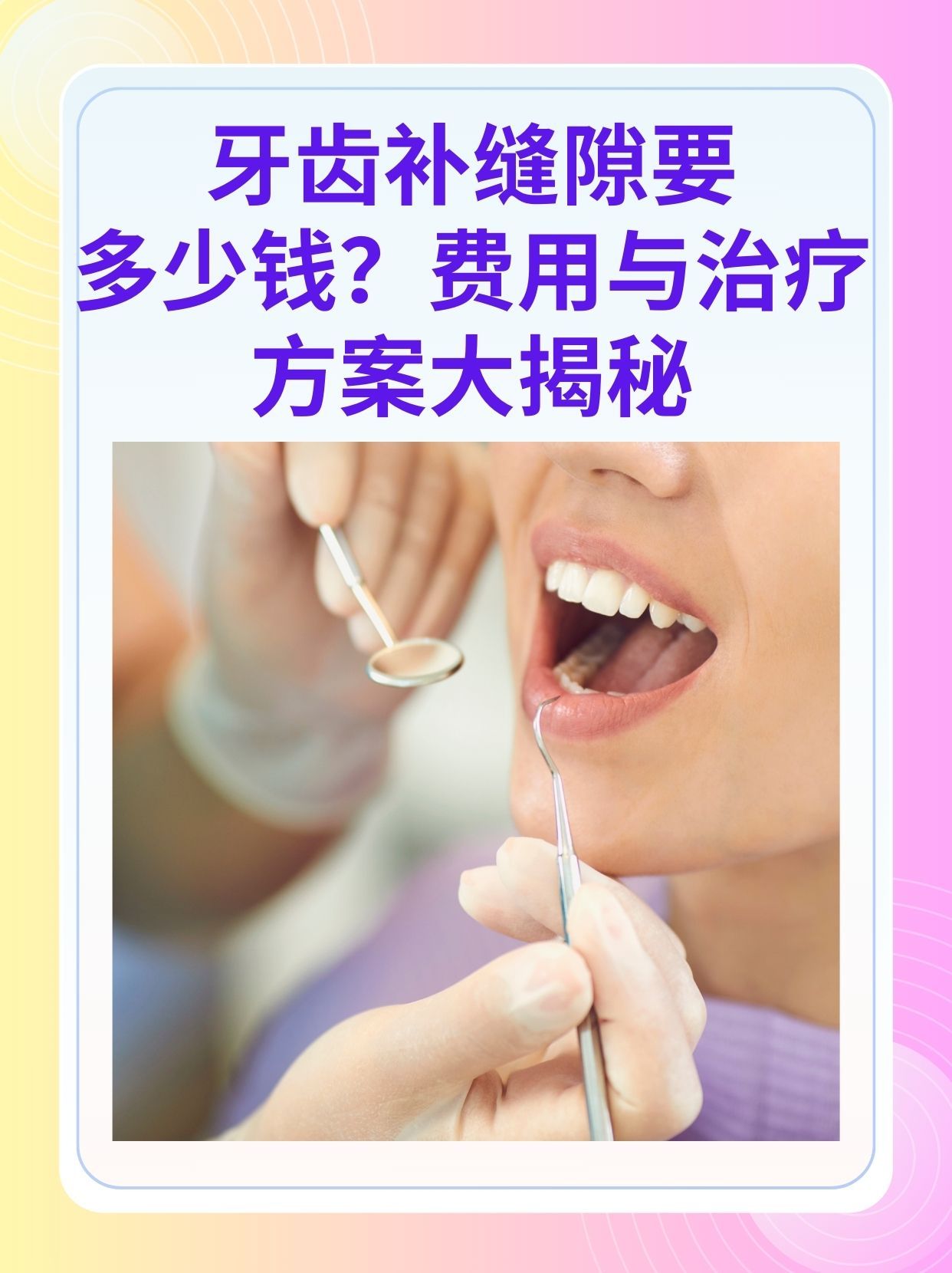 合川补牙医保可以报销吗(补牙医保可以报销吗 哪些可以报销呢)